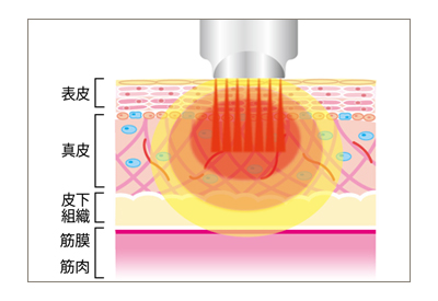 ビービー / BE-BE | 株式会社乾月